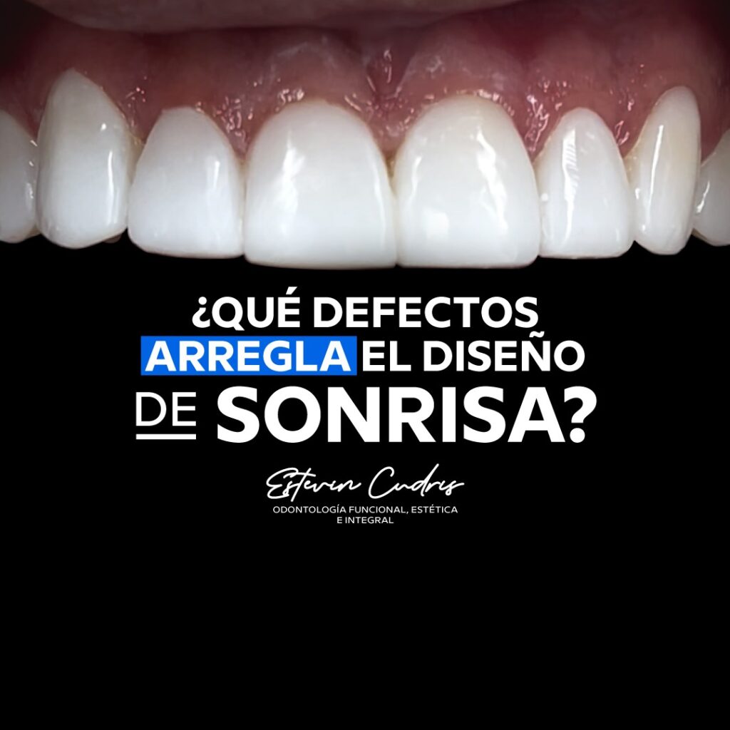 ¿Para qué sirve el diseño de sonrisa?