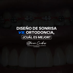 diseño de sonrisa vs ortodoncia